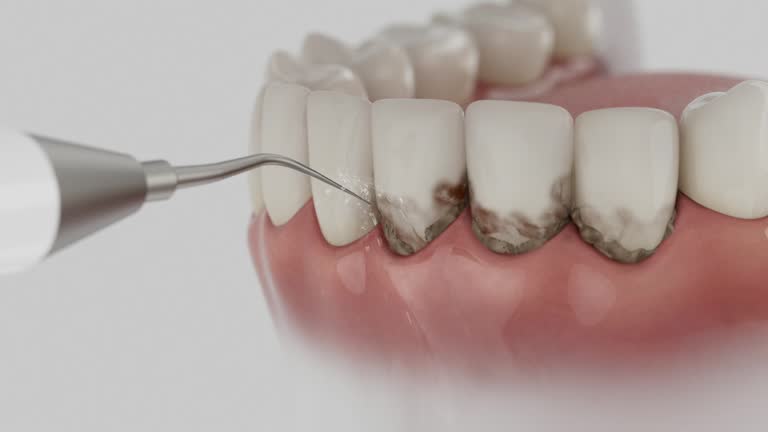 Reliable Dental Implants contractor in Philipsburg, MT by Smile Center Dentistry